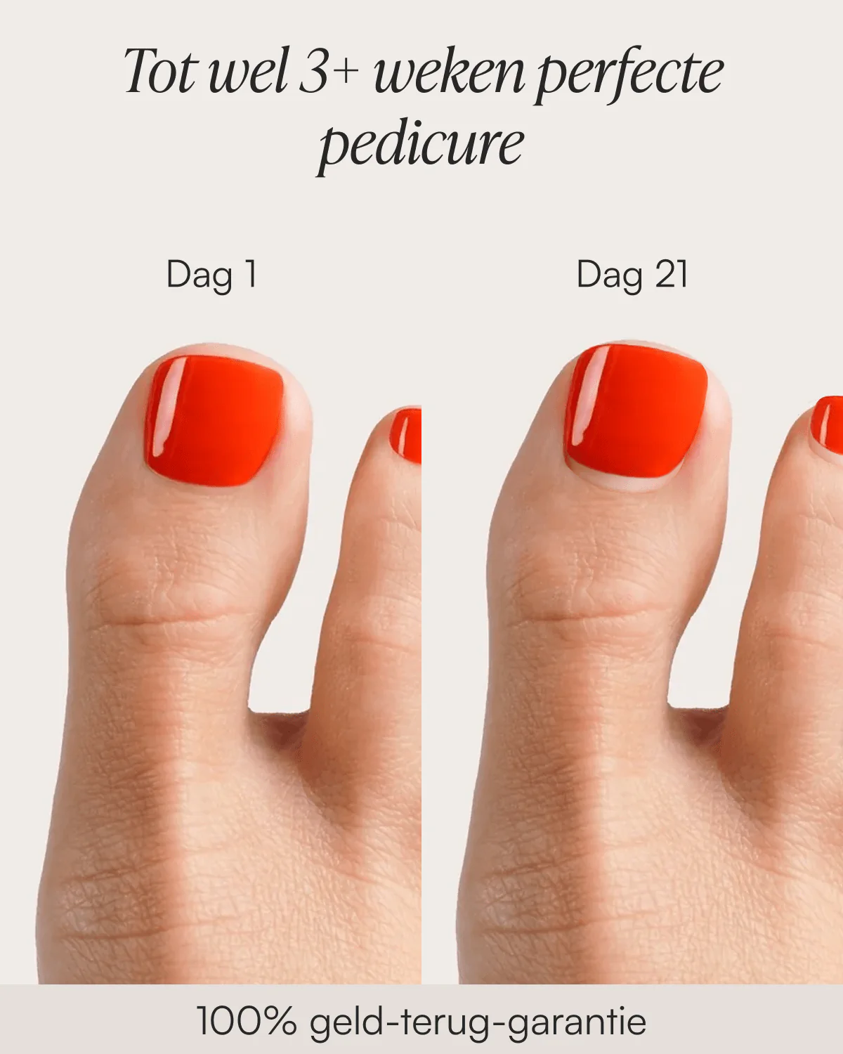 Cheesecake Pedicure Gel Strips - Image 4