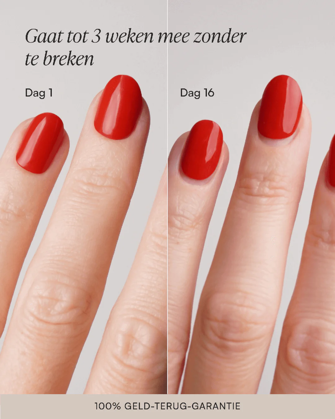 Lente Starterset - Gel Strips - Image 7